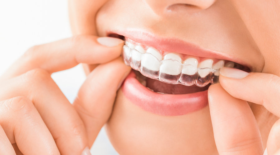 Sonrisa con brackets de ortodoncia